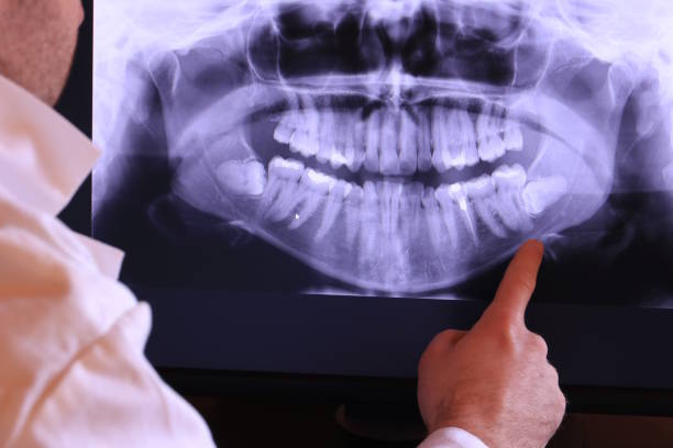 Best Emergency Cosmetic Dentistry in East Hazel Crest, IL